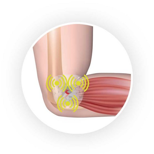 brazalete-epicondilitis-mottio-sport(3)